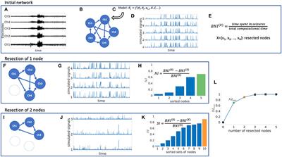 Quantification and Selection of Ictogenic Zones in Epilepsy Surgery